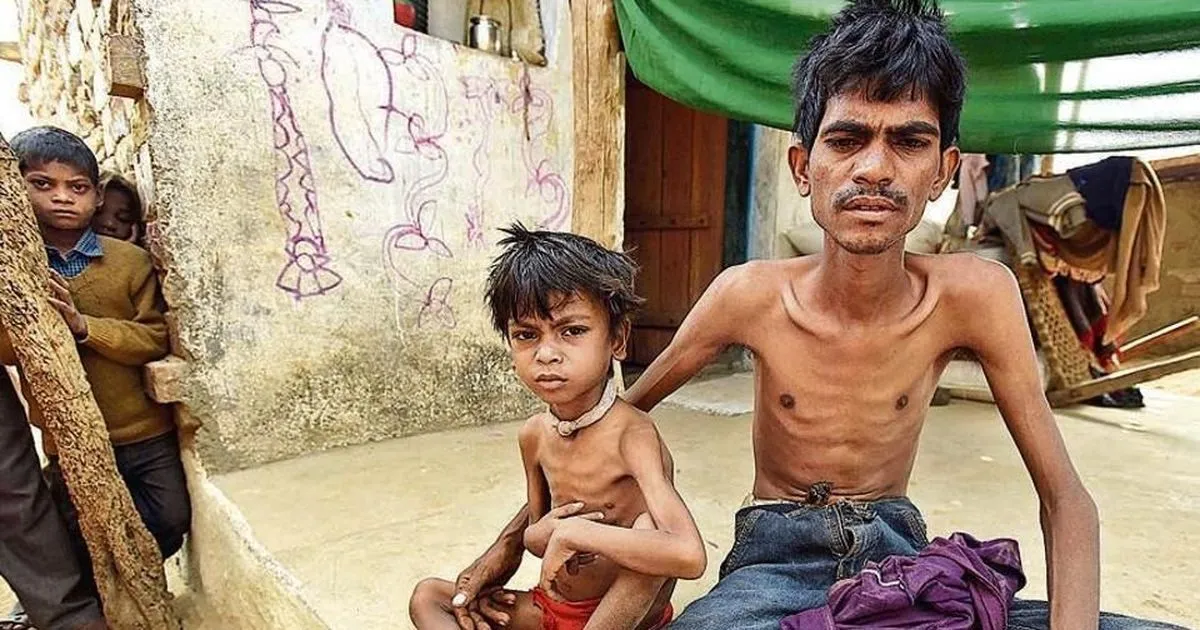 TB patients